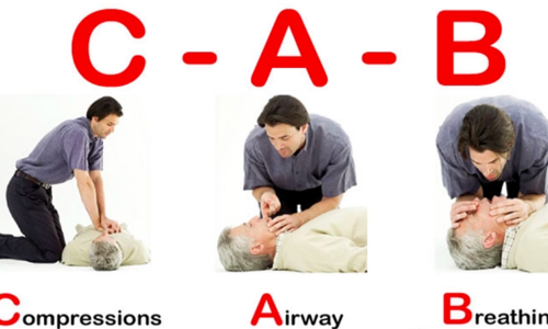 Cách sơ cứu người ngưng tim, ngưng thở