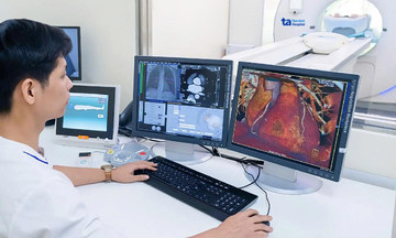 Chụp CT có phát hiện sớm nguy cơ nhồi máu cơ tim không?