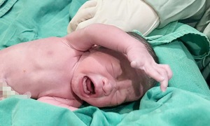 Pregnant woman with cervical cancer receives chemotherapy while carrying child