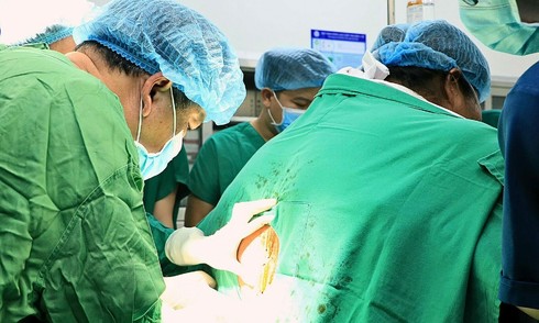 178kg woman undergoes complex c-section