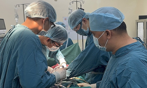 Urethral stricture resolved with oral mucosa graft