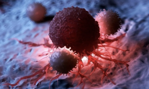 Why are so many young people getting cancer despite healthy lifestyles?