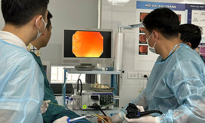 Should you opt for anesthesia during an endoscopy?