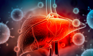 Breakthrough in advanced liver cancer treatment