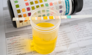 Can urine tests detect HPV?