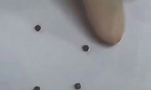 Four magnets perforate young boy's intestines
