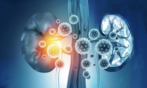 5 facial and neck signs that warn of kidney problems