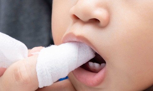4 criteria for choosing tongue cleaners for newborns