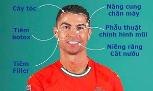 Cristiano Ronaldo's cosmetic procedures explored