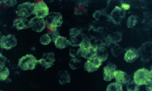 Brain-eating amoeba found in Australian drinking water