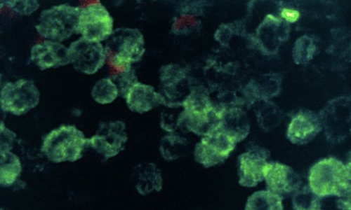 Brain-eating amoeba found in Australian drinking water