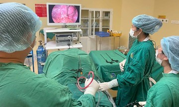 Teenager's ovarian teratoma contains hair and teeth