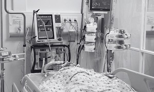 Two siblings critically injured in suspected arson attack by father