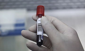 The rise of at-home testing and the dangers of 'friendly doctor' prescriptions