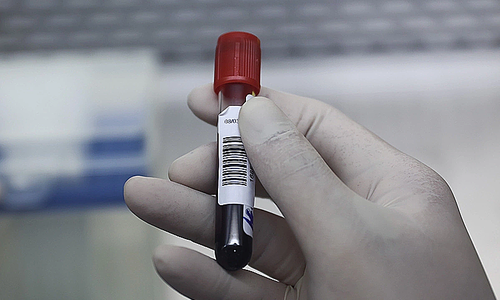 The rise of at-home testing and the dangers of 'friendly doctor' prescriptions