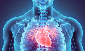 Heart attack at 33