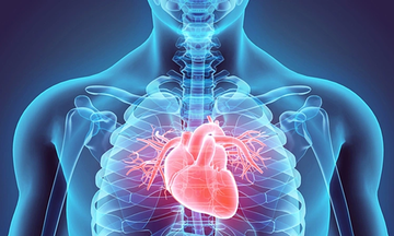 Heart attack at 33