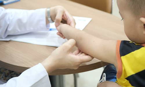 4 mosquito-borne illnesses in children