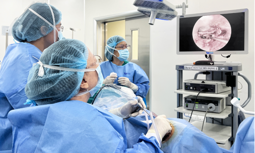 Restoring hearing for a patient with otosclerosis