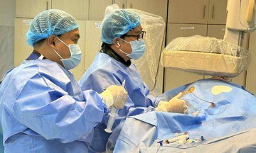 Brain aneurysms: When to intervene?