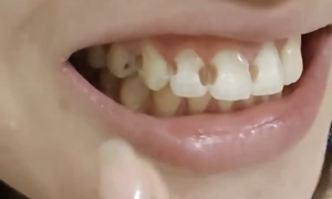 Woman finds 8 cavities after 5 years of braces