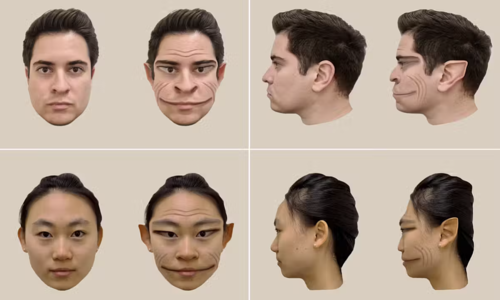 Rare condition makes woman see faces as dragons