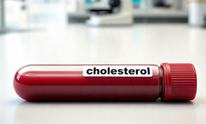 Cholesterol