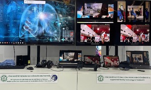 AI application for early lung cancer diagnosis