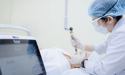 Does 4D laser treatment for dark lips reduce peeling?