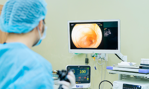 When is a digestive endoscopy necessary?