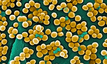 Squeezing a heel blister leads to meningitis