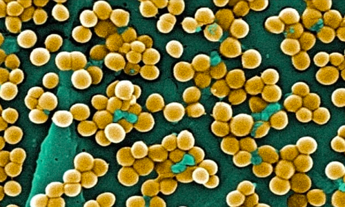 Squeezing a heel blister leads to meningitis
