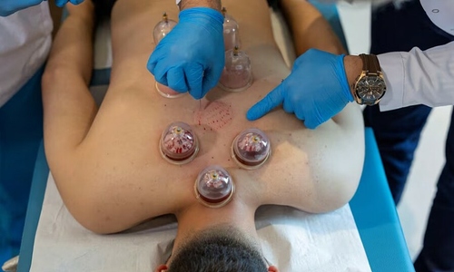Traditional therapies gain traction in Turkish hospitals