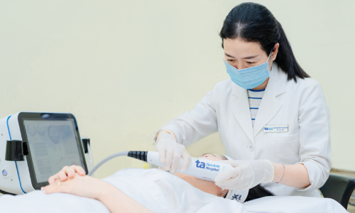 Does facelift work for people over 50?