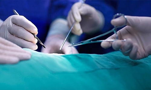 Genital cosmetic procedure leads to complications