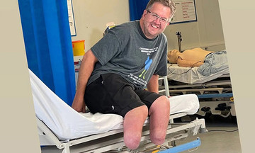 Surgeon amputates own legs in $680,000 insurance scam
