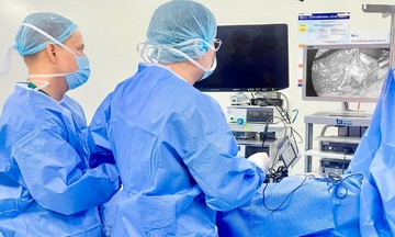 Gallstones develop after 10 years