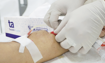 HIV patient with end-stage renal disease avoids dialysis