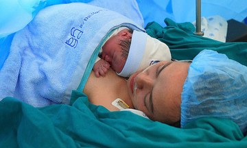 Doctors save baby with giant placental tumor