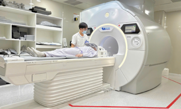 How diabetes increases the risk of stroke
