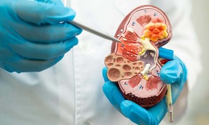 5 seemingly healthy habits that can harm your kidneys