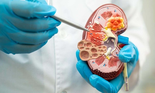5 seemingly healthy habits that can harm your kidneys