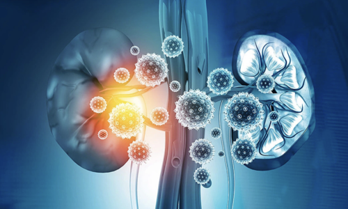6 warning signs of kidney problems you shouldn't ignore
