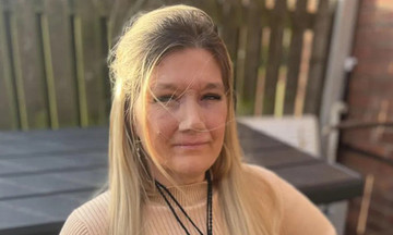 Woman mistakes nosebleeds for allergies, loses nose to cancer