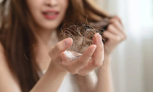 5 ways to prevent hair loss in women