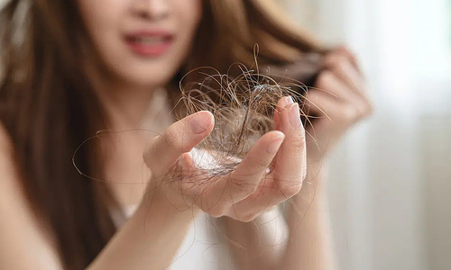 5 ways to prevent hair loss in women