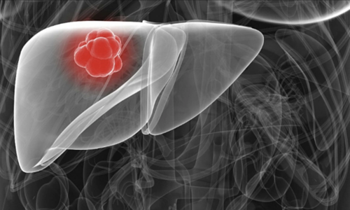 5 silent signs of liver damage