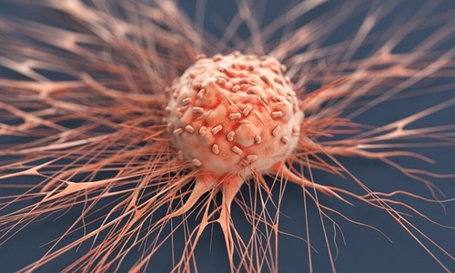Man diagnosed with three types of cancer simultaneously