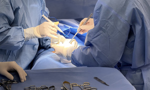 Can surgery address premature ejaculation?
