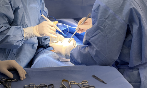 Can surgery address premature ejaculation?
